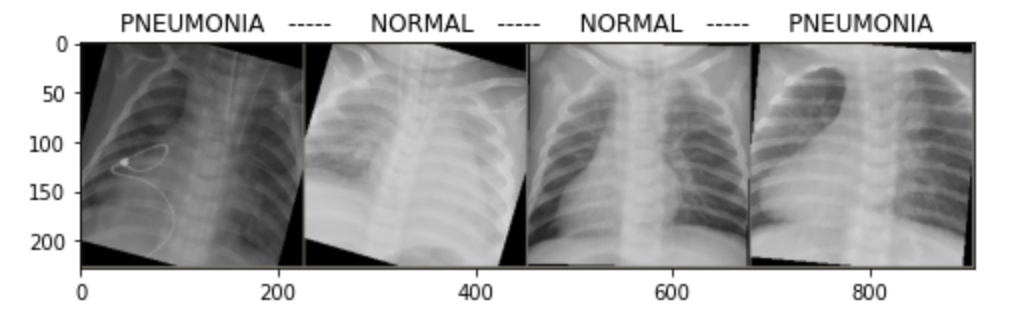 Raw Xray Images